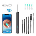 Máy lấy ráy tai nội soi có camera, điều khiển qua app tiện dụng 