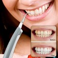 Máy lấy cao răng công nghệ rung tại nhà