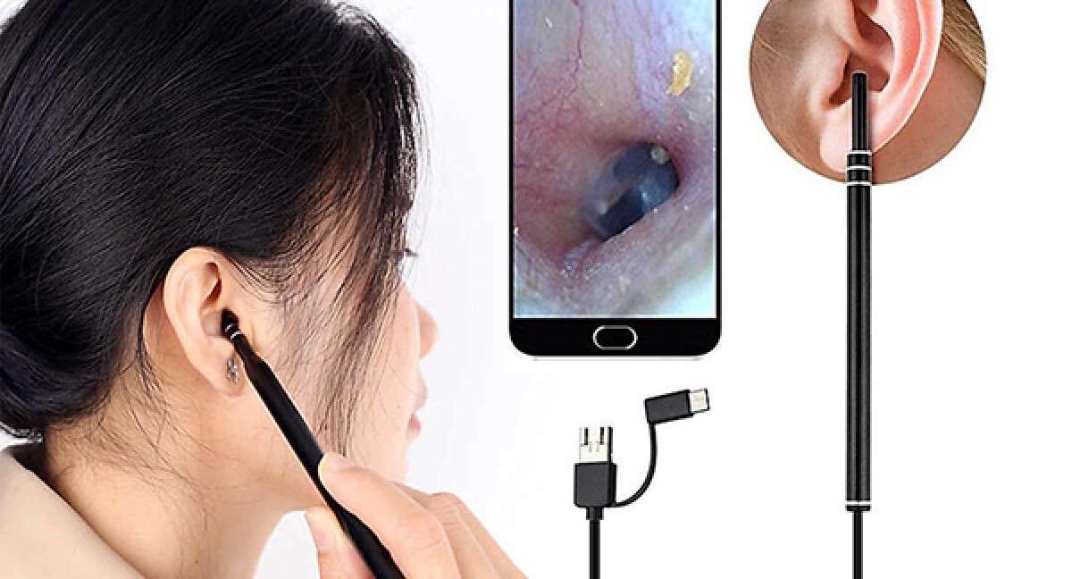 Dụng cụ lấy ráy tai gắn camera mini tiện dụng