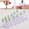 Bộ giác hơi 12 ống hút chân không chuyên dụng