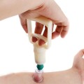 Bộ giác hơi 12 ống hút chân không chuyên dụng