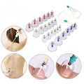 Bộ giác hơi không dùng lửa 24 cốc an toàn cho da