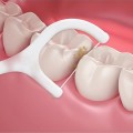 Combo 5 hộp tăm chỉ nha khoa vệ sinh kẽ răng sạch sẽ