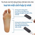 Dụng cụ chà gót chân tẩy tế bào chết tại nhà tiện lợi