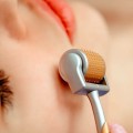 Cây lăn kim cầm tay chuyên dụng hỗ trợ cải thiện làn da